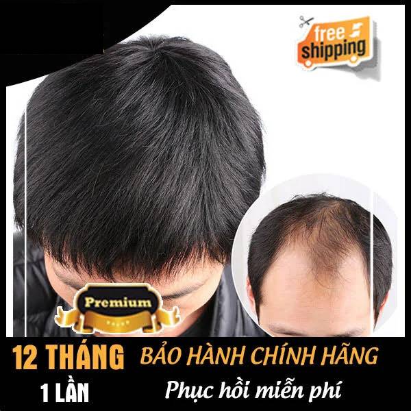 Mái Hói Nam Bằng Tóc Thật Không Da & Siêu Da Đầu TTN-01